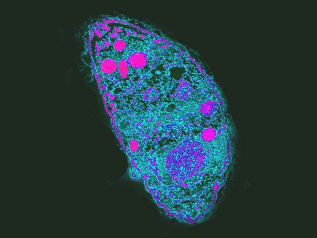 Toxoplasma gondii