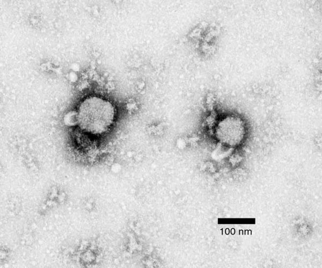 Lymphocytic choriomeningitis